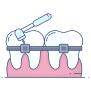 Orthodontic