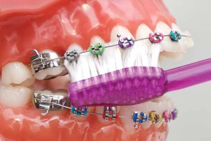 ارتودنسی دندان چیست